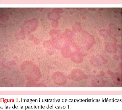 figura 1