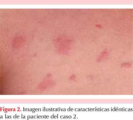 figura 1