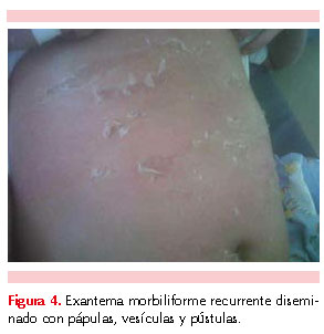 figura 2
