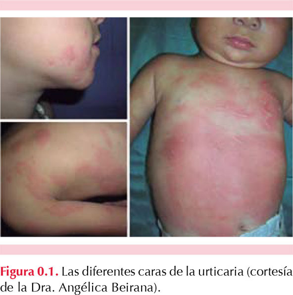 figura 1