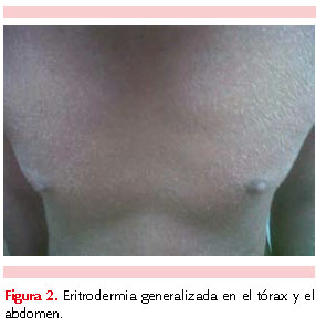 figura 2