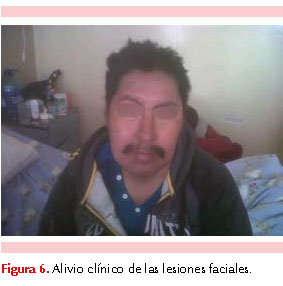 figura 2