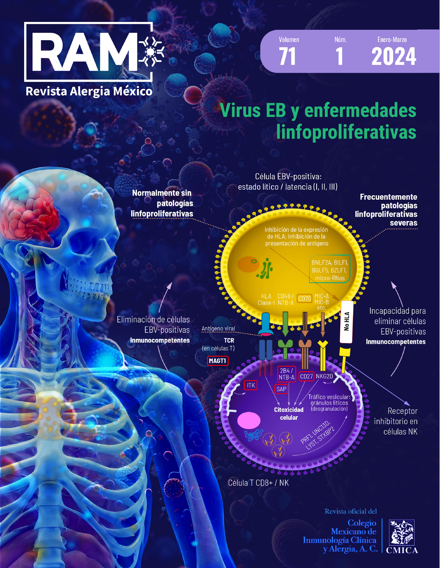 −ACERCA DE LA PORTADA−  El virus Epstein-Barr (EBV) es un gamma herpes virus que afecta humanos. La infección se adquiere principalmente durante la infancia o adolescencia; se presenta de manera asintomática o como un trastorno linfoproliferativo autolimitado que no requiere atención clínica. Sin embargo, afecta a más del 95% de la población adulta mundial y corresponde a uno de los virus oncogénicos más comunes en la especie humana: en promedio, cada año se asocia con 200,000 casos de cáncer. Interesantemente, solo un pequeño porcentaje de individuos infectados desarrolla procesos malignos, normalmente hospederos inmunocomprometidos o inmunodeficientes. EBV tiene un tropismo casi exclusivo por células B y de manera general la infección conduce a un estado latente o lítico, a partir de los cuales es posible desarrollar enfermedades y complicaciones. Las células citotóxicas NK y T CD8+ son los principales agentes inmunológicos que controlan y eliminan la infección por EBV. En este contexto, variantes genéticas que comprometan el desarrollo, proliferación, diferenciación, coestimulación y/o activación de células NK y T CD8+ predisponen al desarrollo de neoplasias o trastornos linfoproliferativos. Específicamente, se ha descrito la deficiencia, haploinsuficiencia o desregulación de ciertas proteínas citoplasmáticas, receptores de membrana, ligandos y transportadores de iones que afectan la función efectora de las células citotóxicas, y resultan en las secuelas más graves por EBV. Sin duda, el conocimiento ganado en este tema seguirá contribuyendo a diagnósticos más oportunos y el desarrollo de mejores estrategias terapéuticas en la clínica.     Breve descripción de la portada: Dres. Arturo Gutiérrez Guerrero, Sara Elva Espinosa Padilla y Saúl Oswaldo Lugo Reyes.   Agradecimiento especial por la elaboración y diseño de la portada: DG. Diana Gabriela Salazar Rodríguez.